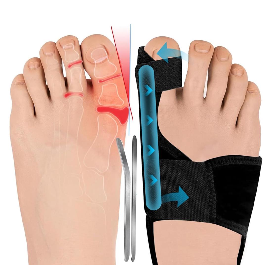 JOYPICK Bunion Corrector 2-Pack for Men & Women  Adjustable Orthopedic Splint for Hallux Valgus Relief, Big Toe Straightener for Day & Night, Comfort Support Brace for Hammer Toe Alignment