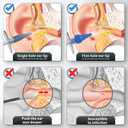 Ear Wax Removal, Ear Cleaner, Ear Wax Removal Kit, Ear Wax Removal Tool, Manual Ear Irrigation Flushing System, Ear Cleaning Kit for Adults & Kids
