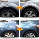 Auto Body Dent Puller Kit, Auto Paintless Dent Repair Kit with Bridge Puller, Dent Puller Kit, Car Dent Removal Kit Powerfully Pops Car Dents and Other Metal Surface Dents