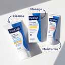 PanOxyl 10% Benzoyl Peroxide Acne Foaming Wash, Maximum Strength, Daily Acne-Fighting Face and Body Cleanser, Face Wash to Clear, Treat and Prevent Acne Pimples and Stubborn Breakouts, 5.5 Oz Tube