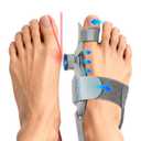 Bunion Corrector for Women & Men Big Toe, Upgraded Big Toe Straightener Bunion Fix with Adjustable Knob, Separator Reliefer with Soft Gel Pad for Left/Right Feet (Gray 1Pcs)