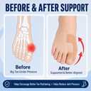 40 PCS Pre-Cut Bunion Corrector Kinesiology Tape for Big Toe Support & Toe Alignment, Hallux Valgus Foot Corrector for Women & Men, Self-Adhesive Toe Support Strips, Skin Color