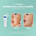 Mustela Stelatopia Eczema-Prone Skin Emollient Baby Face Cream - Face Moisturizer with Natural Avocado & Sunflower Oil - Fragrance-Free - 1.35 Fl Oz (Pack of 1)