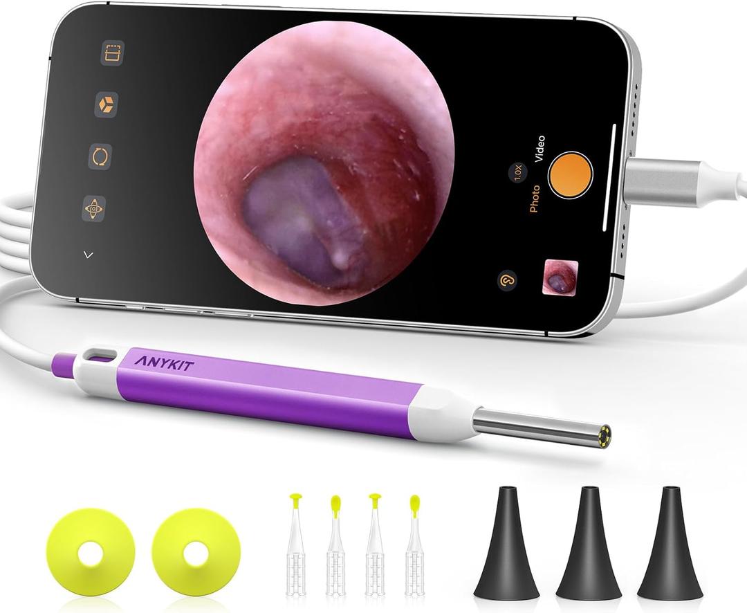 Anykit Digital Otoscope with Gyroscope, HD Ultra Clear View Ear Camera with Ear Wax Removal Tools, Video Ear Scope Otoscope with Light, Compatible with Android, iPhone 15 (Purple)