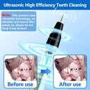 Ni-SHEN Plaque Remover for Teeth - Pet Ultrasonic Cleaner - Teeth Cleaning Kit for Tartar and Stains - Suitable for Dogs and Cats (Black)