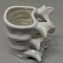 Funny Coffee Mug, Cute Ceramic Coffee Mugs, Novelty Large Ceramic Coffee Pot Mugs, White 12oz Funny Gifts for Nurse, Surgeon, Anatomy Teacher