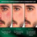 Mens Face Moisturizer Anti-Aging Cream - Lightweight After Shave Lotion for Men - Day & Night Hydrating Skin Care with Niacinamide Collagen Ceramides - Fast-Absorbing Non-Greasy 1.85oz