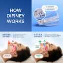 Difiney Anti Snoring Device: FDA-Cleared Anti Snoring Mouthpiece Adjustable Snore Stopper Mouth Guard for Men & Women to Sleep Better Reusable Nighttime Use with Storage Case
