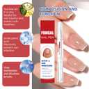 Fungal Nail Renewal Pen for Toes & Fingernails, Nail Care Brush Pen to Help Restore Discoloration, Strengthen Thick & Brittle Nails, Supports Clearer and Healthier Looking Nails (2 PCS)
