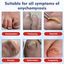 Multi-Purpose Nail Repair, Nail Solution with Tea Tree Oil for Discolored and Damaged NailsPlant Drops for Nails CareDiscolored and Damaged Nails (1PCS) (1 Fl Oz (Pack of 1))