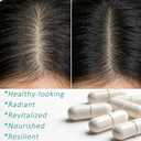 Hair Growth Biotin 10000mcg Supplement with Vitamins A C D E & Calcium - 30-in-1 Formula for Hair & Nails Support, for Women & Men, 30 Servings (1)