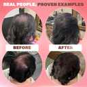 Fibers for Thinning Hair (Light Brown), Undetectable Hair Powder for Women & 100% Natural Hair Building Fibers - Conceals Hair Loss - Bald Spot Cover Up Hair Powder, 2 Month Supply