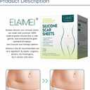 3 x Medical Grade Silicone Scar Sheet, Silicone Scar Tape (1.6x 120"), Scar Removal Strips for Acne Scars C-Section & Keloid Surgery Scars Sheets Treatment Sheets - 6-8 Month Supply, Expiry: 02/08/2025