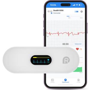 Portable Heart Rate Monitor, Wireless Home Use Heart Rhythm Tracker, Heart Monitoring Devices,Smartphone App Compatible with iOS/Android