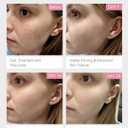 Red Light Therapy Device for Face and Neck, 3-in-1 Microcurrent & Vacuum Facial Massager, Skin Tightening, Firming and Anti-Aging Skincare Tool (White)