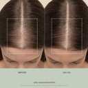 VEGAMOUR GRO+ Advanced Hair Serum for Hair Density, Reduces Shedding and Promotes a Healthy Scalp, Helps with Severe Signs of Thinning, Made Without Fragrance, Vegan, Cruelty-Free