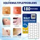 Maximum Strength Salicylic Acid Wart Remover Patches, 180 Count, Hydrocolloid Waterproof Invisible Stickers, Easy-to-Use Targeted Care for Plantar and Common Warts-180Count-1 Pack
