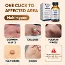 6 x "STAY STOKED" Wart Remover, 15ml Fast-Acting Wart Freeze Off with Natural Herbal Extracts - Gentle Yet Powerful for Common Warts, Plantar Warts on Hands/Feet-0123