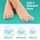 Welnove Hammertoe Corrector - 6 PCS Toe Splints Realign Bent, Curled, Crooked, Claw, Hammer Toes - Toe Straighteners for Men and Women - Large,Blue