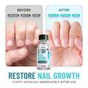 Stop Nail Biting Treatment for Kids & Adults Bitter Taste No-Bite Nail Polish, Thumb Sucking Deterrent, Non-Toxic Safe Formula, Supports Healthy Nail Growth 0.5 fl oz