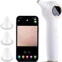 Blackhead Extractor with Camera, Black Head Remover for Face,Pore Extractor for Black Head and Acen, Blackhead Remover Tools with USB Rechargeable, Blackhead Remover Vacuum (White)