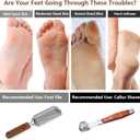 Colossal Foot Rasp & Wood Handle Callus Shaver (10 Replacement & 1 File Foot Heads), Pedicure Foot File Kit, Heel Scraper for Feet, Foot File Callus Remover