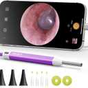 Anykit Visual Ear Wax Removal Camera, Type-C Digital Otoscope with 6 LED Lights and Ear Camera with Earwax Removal Tool for Adults & Children, Compatible with iPhone 15& Android (Purple)