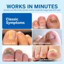 2 x Toenail Fungus Treatment Extra Strength - Toe Nail Fungus Treatment Extra Strength - Nail Fungus Treatment for Toenail and Finger Nail