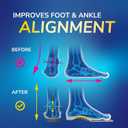 Dr. Scholls Flat Feet Support Insoles for Women, Size 6-10: Immediately Relieve Discomfort, Cradle Feet & Improve Ankle Alignment, Due to Overpronation,Low & Fallen Arches, Reduces Lower Body Stress