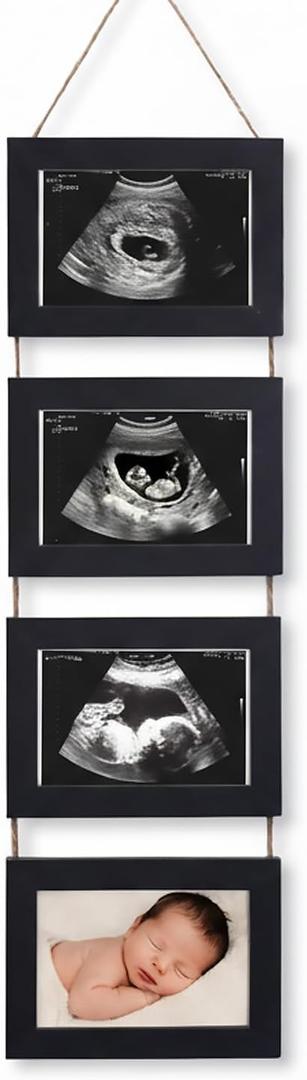 4-in-1 Sonogram Picture Frame, Display Pregnancy Keepsake Album for Pregnancy Announcements, Gender Reveal, and Newborn Photos, Perfect Gender-Neutral Nursery Decor, First Time Mom Gift, Black