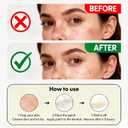 4 x Acne Patches for Face, 36 Count Clear Pimple Stickers, Blemish Cover for Acne