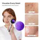 30x Magnifying Dermatoscope with LED, Rechargeable Handheld Skin Analyzer, 4 Lighting Modes & High Clarity Lens for Skin, Scalp & Hair Follicle Observation