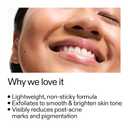 The INKEY List Mandelic Acid Treatment, Treats Hyperpigmentation, Fades Acne Marks, Fragrance-free, Suitable For All Skin Types