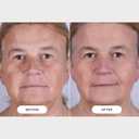 CurrentBody Skin LED Light Therapy Mask: Series 2