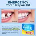 Temporary Tooth Repair Kit: Moldable Thermal Beads Replacement Kit Replace Missing or Broken Tooth Filling The Gap - Come with 3 Shades 10 Size