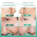 2 x Salmon PDRN Serum, Concentrate 10,000ppm PDRN Salmon DNA for Skin Glow, Skin Barrier Restoration & Plumping, Smoothing Fine Lines & Firming, Hydrating & Calming, Skincare (30ml, 1.0 fl.oz.)