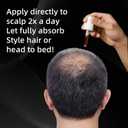 PP405 Hair Treatment, SCU-405 Hair Growth Oil, Infused with PP405 for Hairloss & Baldness, Hair Growth Serum for Women&men 2.11 Fl.Oz / 60ml