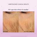 Philosophy Ultimate Miracle Worker Nourish & Rejuvenate Face & Neck Cream - With Patented Retinol, Ceramides & Pro-Collagen Peptides - Smoothes Fine Lines & Wrinkles 