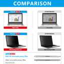 FILMEXT Privacy Screen for Macbook Pro 14 inch (2026-2021,M5 M4 M3 M2 M1), Removable Macbook pro 14.2" A3112 A3401 A2992 A2918 A2779 A2442 Privacy Laptop Screen Filter Anti-Spy/Anti-Glare/Eye Care