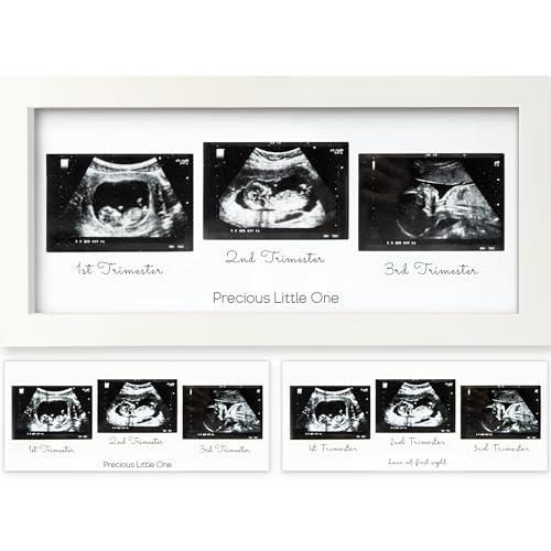KeaBabies Baby Sonogram Picture Frames - Trio Ultrasound Picture Frame, First Time Mom Gift, Cute Pregnancy Reveal Photo Frame, Baby Gender Reveal & Mother's Day, Newborn Nursery Decor (Alpine White)