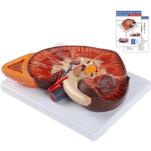 QzzXoq 3X Enlarged Kidney Model - PVC Human Kidney Anatomy Models Biology Demonstration Includes Anatomy of Adrenal Gland and Nephrons for Doctor's Offices, Medical Learning Resources