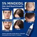 6 Pack 5% Minoxidil with Biotin, Hair Growth Treatment, Minoxidil Hair and Beard Growth Serum, Minoxidil for Men and Women, Supports Thicker and Fuller Hair & Beard (12 fl oz, 6 Month Supply)