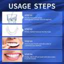 Temporary Veneers Kit for Women and Men, Tooth Replacement Kit, Nature and Comfortable (1 Count (Pack of 1), Unflavored)-NN03