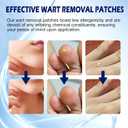 Maximum Strength Salicylic Acid Wart Remover Patches, 180 Count, Hydrocolloid Waterproof Invisible Stickers, Easy-to-Use Targeted Care for Plantar and Common Warts-180Count-1 Pack