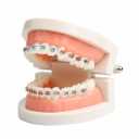 Dental Orthodontic Teeth Model with Braces Denture Mouth Model for Dentistry