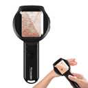 Handheld Dermatoscope, 500X Magnification Skin & Scalp Analyzer for Scalp/Hair Trichomes Facial Skin Dermatoscope, 16MP Camera for Hair Follicle Observation, Digital Microscope with 2.8" Screen