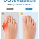 Bunion Corrector, Toe Separators for Women Men Big Toe, Toe Spacers, Bunion Correction, Breathable (2PCS)