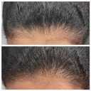 DHT BLOCKER Deep Moisturizing Hair Growth Conditioner (10,14oz) Clinical Strength Formula, VISIBLE RESULTS in 90 days, Hair Regrowth Treatment, Prevents Hair Loss, For Men & Women