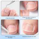 Ingrown Toenail Corrector Set with Breathable Ingrown Toenail Strips Curved Toenails Corrector Patch, File and Lifter Professional Pedicure Tools for Women and Man
