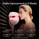 INIA Glow 4D Wireless Red Light Therapy Mask for face Dual NIR, 320 LEDs, 4 Modes, Under-Eye Cooling, Cordless & Rechargeable LED Face Mask for Home & Travel, Skincare Gifts for Women Mom Wife, Pink